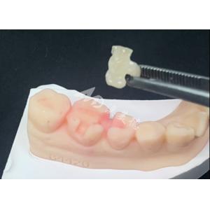 China Emax Ceramic Inlays Onlays Dental Restorations For Natural Tooth Color on sale