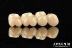 Ultra-precision processing Zirconia Implants All-Zirconium Integrated Crown