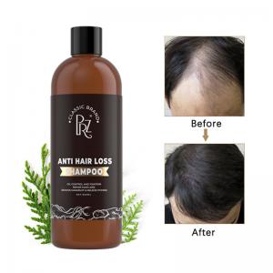 China Argan Oil Anti Dandruff Anti Hair Loss Shampoo And Conditioner Customized Private Label on sale