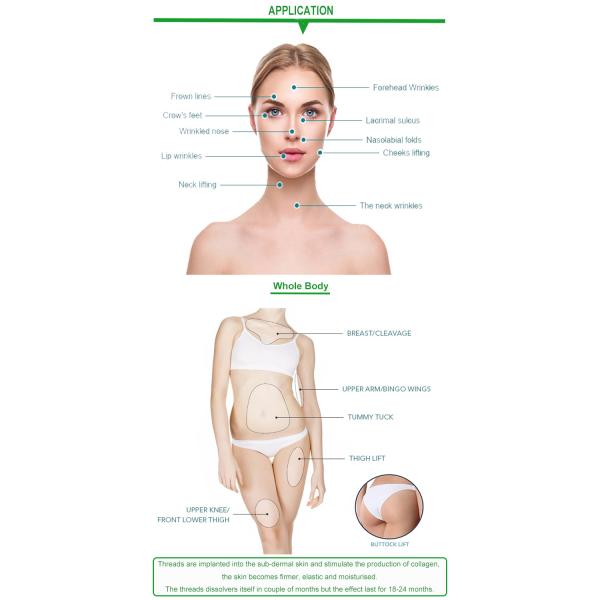 Cog Pdo 3d Barb Polydioxanone Thread Lift Health With Blunt Cannula