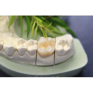 Buy cheap Design Dental Lab Monolithic Zirconia Dental Crown For Molars Posterior Teeth from wholesalers