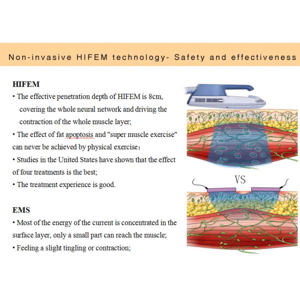 1mhz Ems Infrared Ultrasonic Slimming Machine