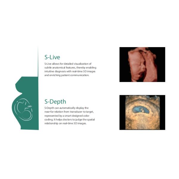High Quality Sonoscape 4d 3d Ultrasound Machine Ultrasonido Veterinariy Human Ultrasounde Scanner