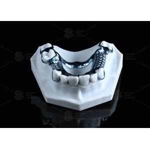 Hypoallergenic Adjustable And Customizable 3D Printed Titanium Framework With