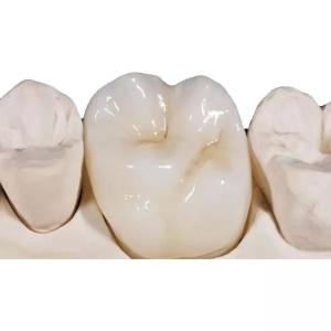 Quality White Porcelain Zirconia Dental Crown High Density Unobstructed wholesale