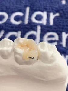 Quality Dental Composite Inlays And Onlays Ivoclar Nexco High Esthetics wholesale