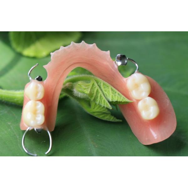 Partial Removable Acrylic Partial Denture