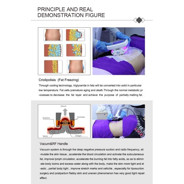 DM-55 Portable RF Cryolipolysis Slimming Machine 350mW pulse Fat Freezing