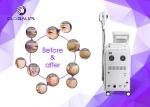Wrinkle Removal Skin Tightening Pigment Therapy RF Elight IPL Laser Beauty