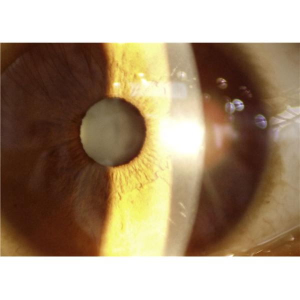 Telemedicine Application Ophthalmology Device Portable Slit Lamp With Slit Width 0-12mm Continuously Adjustable