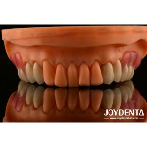 Framework Setup Teeth Finish Elaborate Technology Beautiful Harmonious