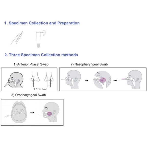 15 Minutes Antigen Swab Test Kit Of Covid-19 25 Tests/Kit CE Specificity 100%