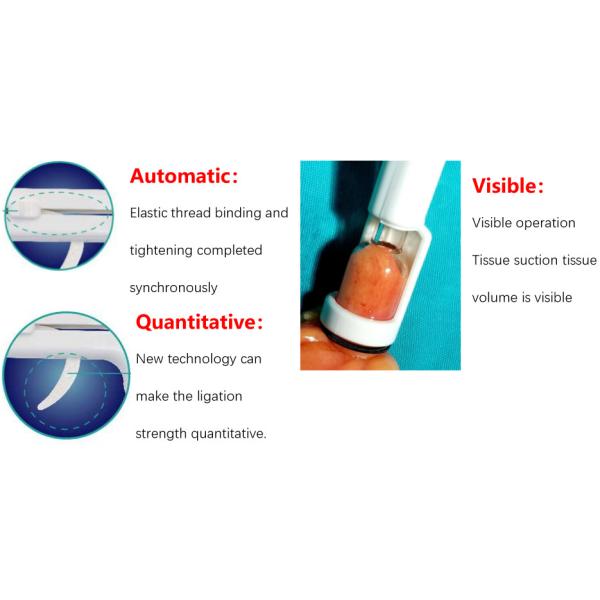 No Foreign Body Matters Hemorrhoid Band Ligator White Color Easy Operation