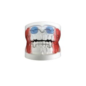 Quality Fixed Appliance Dental Functional Appliance Good Fixation Adequate Anchorage wholesale
