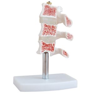 Buy cheap Hospital Education Osteoporosis 0.4kg Life Size Human Skeleton Model from wholesalers