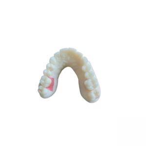 Quality Digital Oral Scanning PFM Dental Crowns Bridge Implantology Demands wholesale