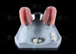 Silver Key And Keyway Attachment Easy Maintenance Precision Attachment Dental