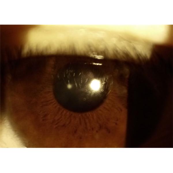 Telemedicine Application Ophthalmology Device Portable Slit Lamp With Slit Width 0-12mm Continuously Adjustable