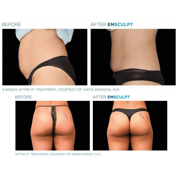 Build Muscle Burn Fat Muscle Stimulation Body EMShape Ems Culpt Machine