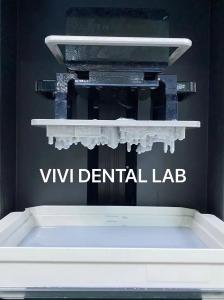 China Digital 3D Printing Dental Crowns Tooth Professional Accurate on sale
