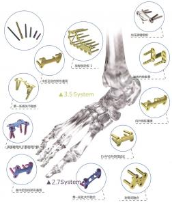 Quality Orthopedic Implant Bone Fracture Titanium Locking Plate For Hands Foot wholesale