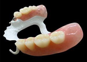 Quality Customized Partial Removable Denture with High-Performance Polymer (HPP) Framework for Superior Comfort and Durability wholesale