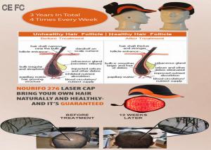 Quality Hair Loss System Helmet Cold Laser Hair Growth Cap for Hair Growth Faster wholesale