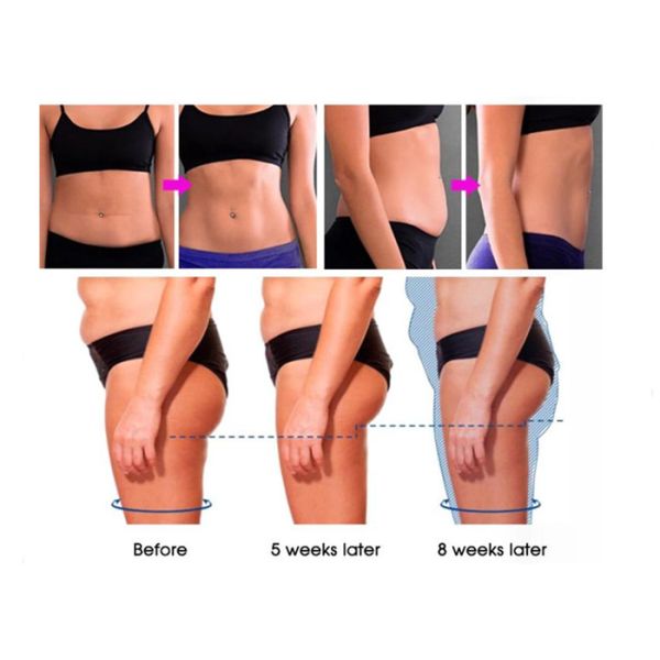 Fda 13 Tesla Ems Slimming Machine 300us Pulse