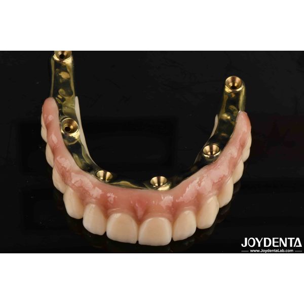 Dental Prosthesis Ti-Bar Zirconia Hybrid Bridge With High Biocompatibility