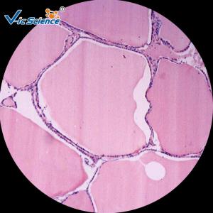 China Laboratory Pathology Microscope Slides / Human Pathology Slides Set 100 Pieces on sale