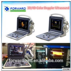 China economical laptop color doppler & laptop 2D ultrasound on sale